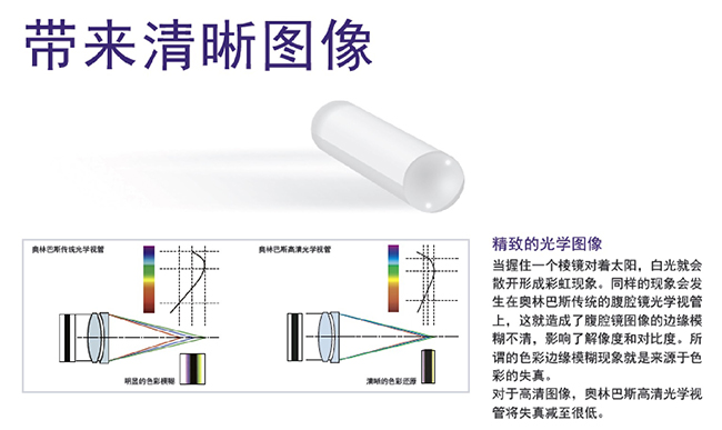 奧林巴斯高清腹腔鏡